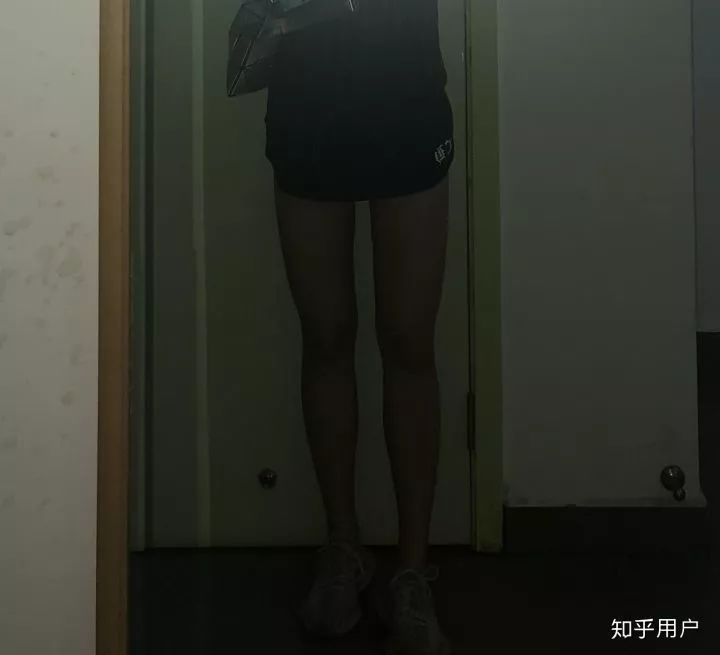 小腿抽脂会反弹吗_反弹腿抽脂会小肚子吗_反弹腿抽脂会小腿变粗吗
