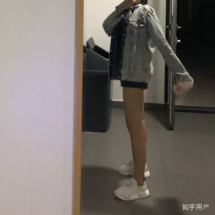 反弹腿抽脂会小腿变粗吗_反弹腿抽脂会小肚子吗_小腿抽脂会反弹吗