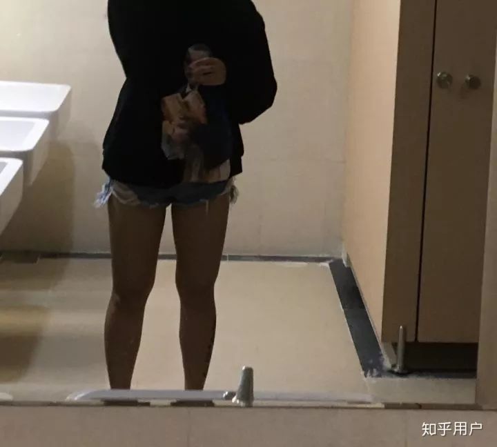 小腿抽脂会反弹吗_反弹腿抽脂会小腿变粗吗_反弹腿抽脂会小肚子吗
