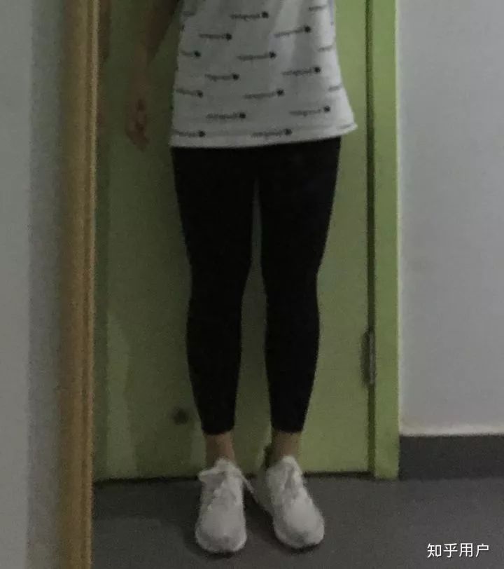 小腿抽脂会反弹吗_反弹腿抽脂会小肚子吗_反弹腿抽脂会小腿变粗吗