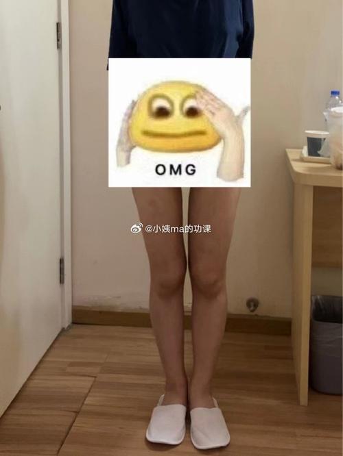 反弹腿抽脂会小肚子吗_小腿抽脂会反弹吗_反弹腿抽脂会小腿变粗吗