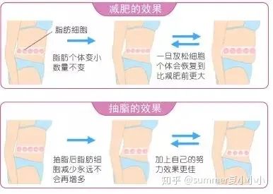 腿部抽脂反弹后会更粗吗_小腿抽脂会反弹吗_反弹腿抽脂会小腿变粗吗