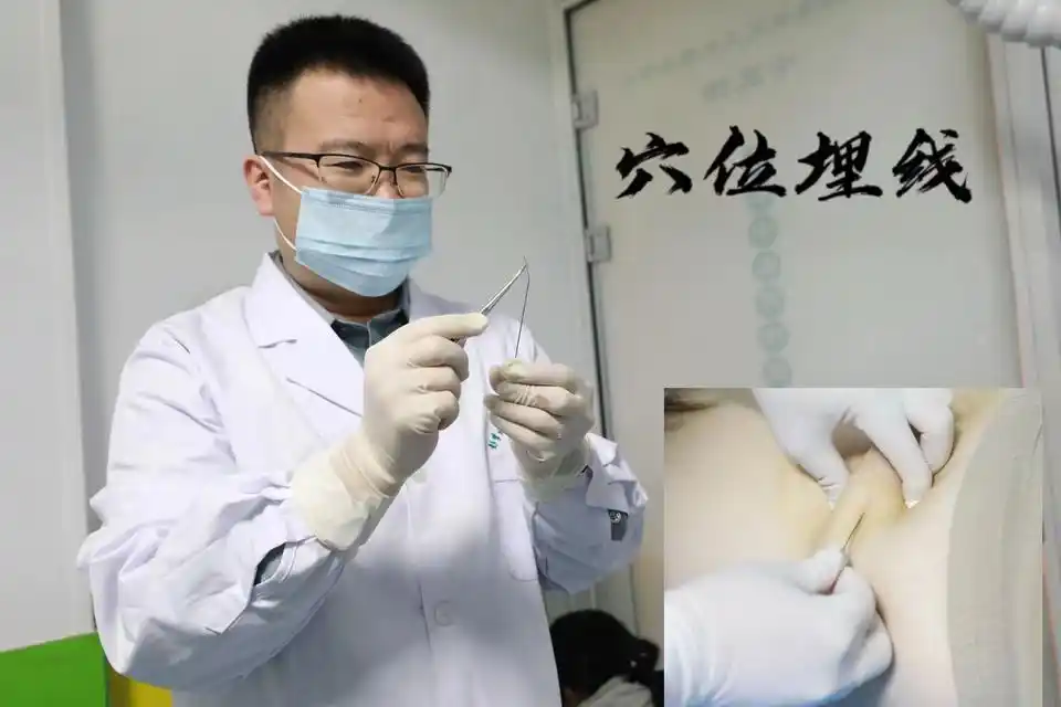 国家喊你减肥冲上热搜，穴位埋线减肥背后真相大揭秘