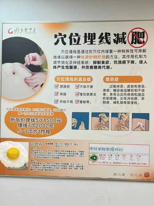 穴位埋线减肥方法_埋线减肥安全性分析_抽脂埋线后会反弹吗